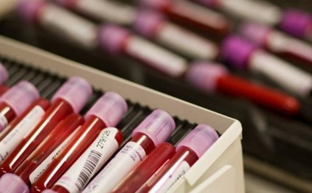 ΣΟΚ στην Πάφο: Πέθανε από μετάγγιση αίματος