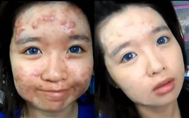 Βίντεο: Δεν θα πιστεύετε τη μεταμόρφωση αυτής της κοπέλας