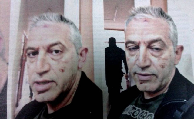 Εικόνα - ΣΟΚ: Καταγγέλλει άγριο ξυλοδαρμό από ελεγκτή στο Μετρό