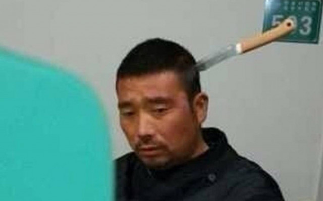 Έπαθαν ΣΟΚ: Περίμενε στην ουρά με ένα... μαχαίρι στο κεφάλι!