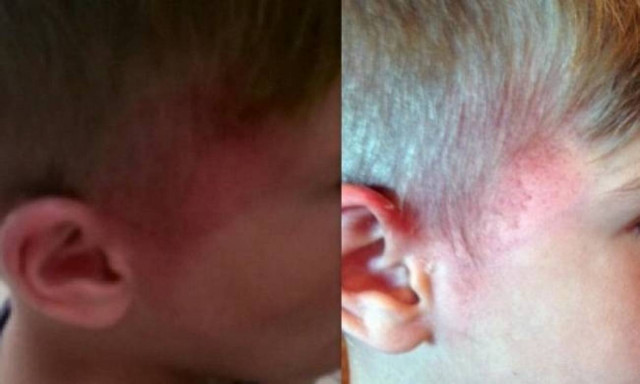 Σοκ: Γιος διάσημου ηθοποιού κακοποιημένος στο πρόσωπο!