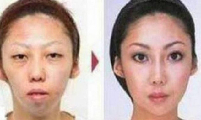 Χώρισε την σύζυγό του γιατί γέννησε άσχημο παιδί!