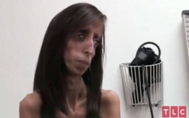 Απίστευτο:Πρέπει να τρώει 60 φορές την ημέρα για να μην πεθάνει! (vid)