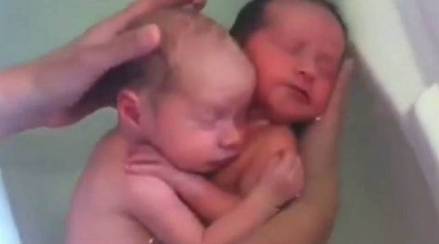 Συγκλονιστικό βίντεο αποδεικνύει το «δέσιμο» που έχουν τα δίδυμα