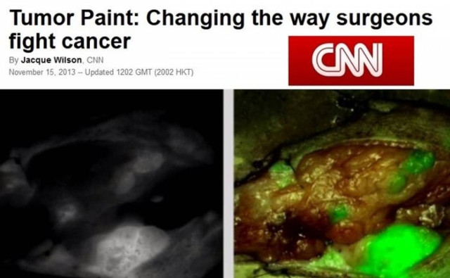 Καρκίνος: «Φωτίζουν» τους όγκους με χρώμα