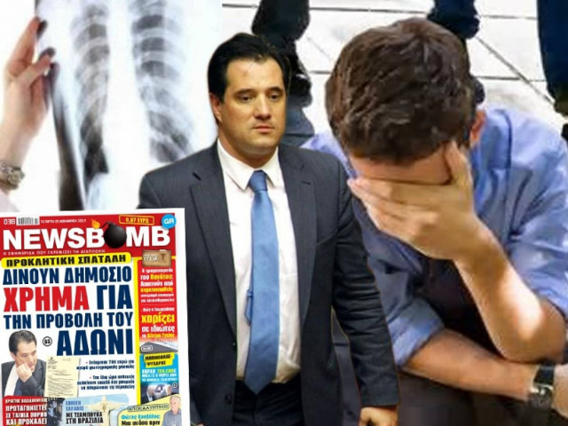 Ζητούν από άνεργο 152 ευρώ για μια ακτινογραφία