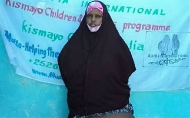 ΣΚΛΗΡΕΣ ΕΙΚΟΝΕΣ: Πάσχει από ελεφαντίαση - Το πόδι της ζυγίζει 31 κιλά