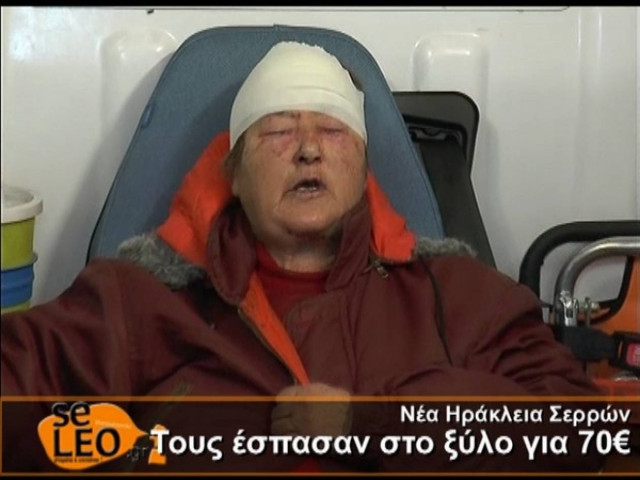 Βίντεο-ΣΟΚ: Με ξυλοκόπησαν για 70 ευρώ