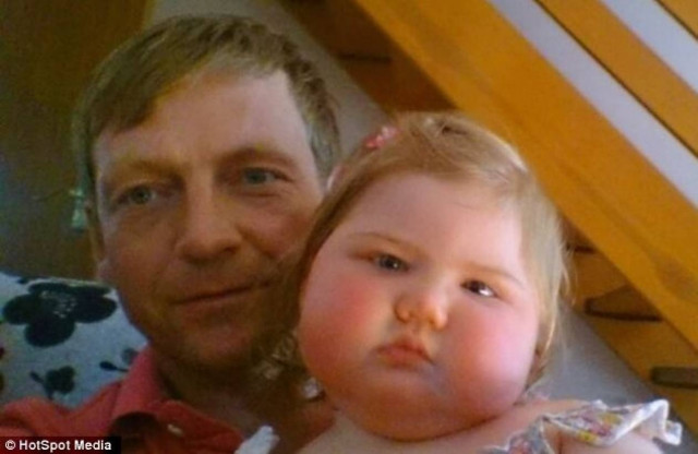 2χρονο κοριτσάκι με σπάνια πάθηση-Ξεχνάει όσα έχει ζήσει και μάθει