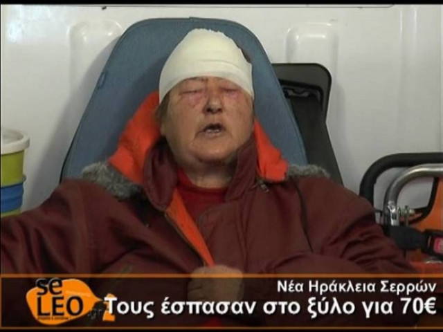 Συνελήφθη ο 36χρονος που ξυλοκόπησε ζευγάρι στις Σέρρες