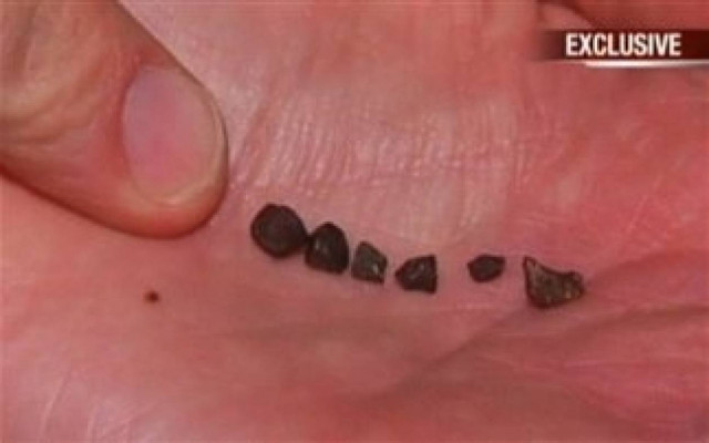 Απίστευτο: Μετεωρίτες έπεσαν στο... κεφάλι 7χρονου (pics)