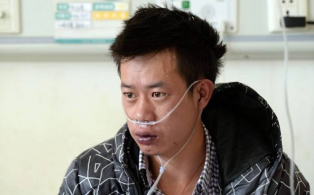 Απίστευτο: Γεννήθηκε με την καρδιά στην... κοιλιά του! (pics)