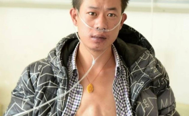 Κίνα: Η καρδιά 24χρονου προεξέχει από το στομάχι του