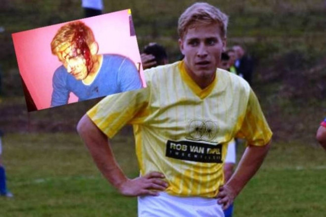 ΣΟΚ στη Ρουμανία, επιτέθηκαν σε ποδοσφαιριστή με τσεκούρι!