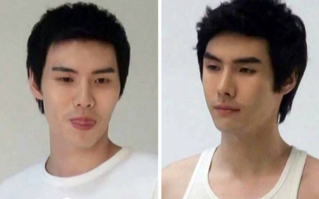 Κορεάτες πριν και μετά την πλαστική (pics)