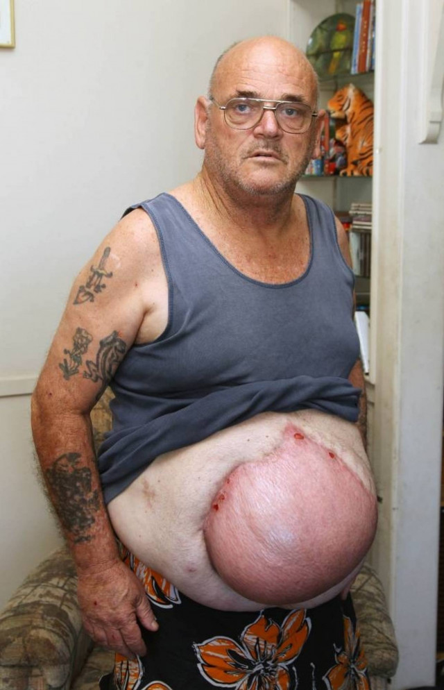 Δείτε τι έπαθε όταν ήπιε μπύρα! Εικόνα-Σοκ