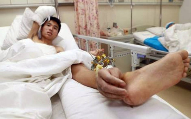 ΣΟΚΑΡΙΣΤΙΚΕΣ ΕΙΚΟΝΕΣ: Του έραψαν το χέρι στον... αστράγαλο!