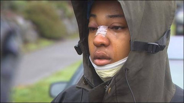 Απίστευτο: Σώθηκε από σφαίρα χάρη στα γυαλιά της