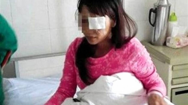 ΦΡΙΚΗ: Έβγαλε το μάτι της συζύγου του με τα χέρια