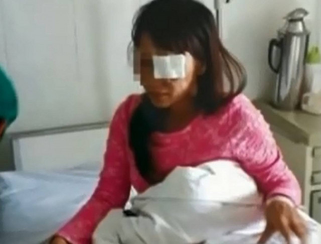 ΦΡΙΚΗ: Τον απάτησε και εκείνος της... έβγαλε το μάτι με τα χέρια του