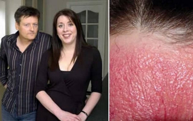 Απίστευτο: Υπάρχει γυναίκα που είναι αλλεργική στην τεχνολογία