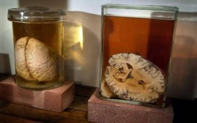 ΣΟΚ: Έκλεβε... εγκεφάλους και τους πουλούσε στο διαδίκτυο!