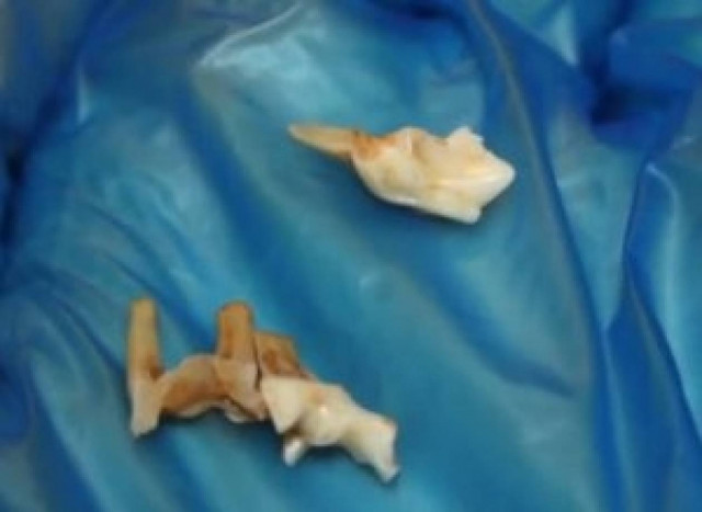 Έπαθε ΣΟΚ όταν μέσα στα φυστίκια που έτρωγε βρήκε ένα...