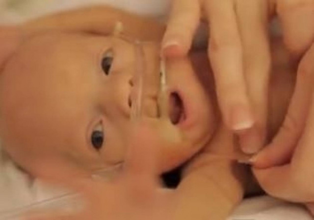 Ήρωας της ζωής ζυγίζει μόλις... 680 γραμμάρια! (video)