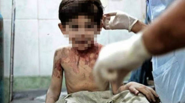 Η συγκλονιστική φωτογραφία που κάνει το γύρο του διαδικτύου