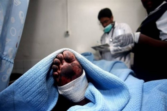 Έπαθαν ΣΟΚ στο νεκροτομείο όταν το πτώμα... σηκώθηκε!