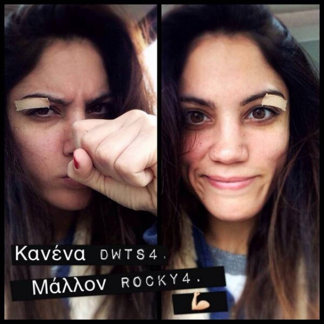 Άουτς! Η Συνατσάκη τραυματίστηκε