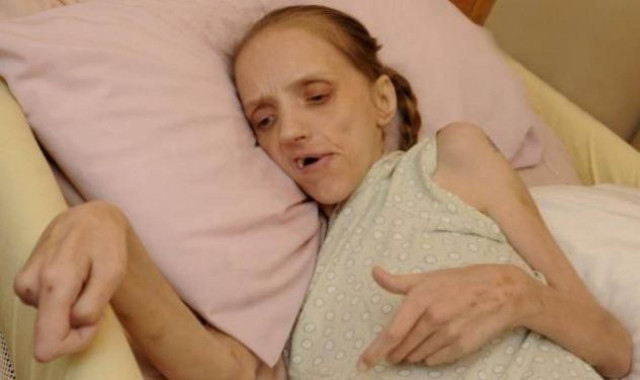 «Λιώνει» στα 35 της, εξαιτίας του αλκοόλ