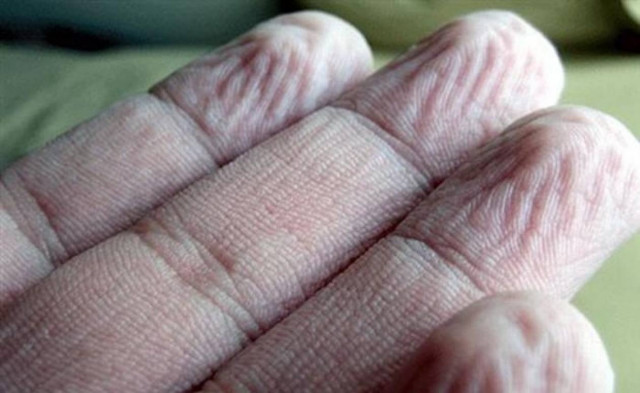 Γιατί τα δάκτυλα ζαρώνουν στο νερό... Ένα άλυτο μυστήριο!