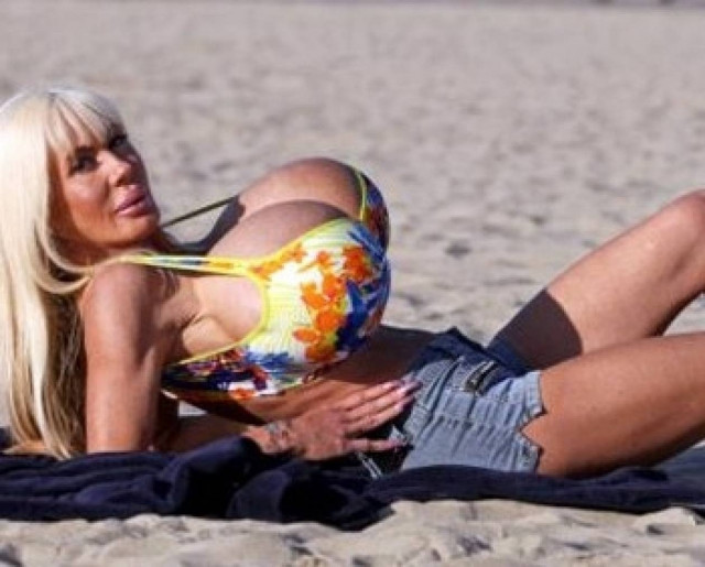 «Οι πλαστικές στο στήθος μου κατέστρεψαν τη ζωή» - Δείτε πώς έγινε!