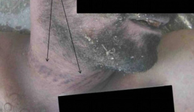 ΕΙΚΟΝΕΣ ΠΟΥ ΣΟΚΑΡΟΥΝ από βασανιστήρια στη Συρία