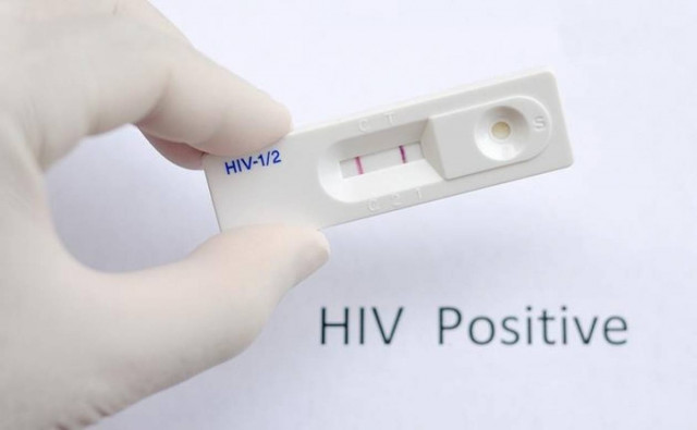 Οροθετικός φοιτητής μετέδωσε εσκεμμένα τον HIV σε 30 άτομα