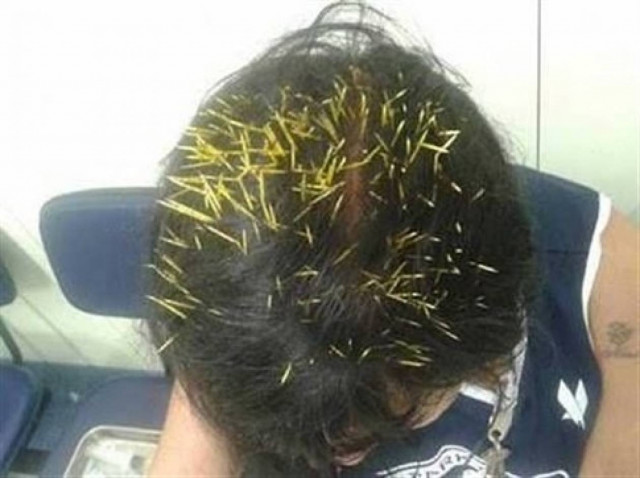 ΦΡΙΚΗ: Δεν πίστευε ότι προσγειώθηκε στο κεφάλι της ένας...