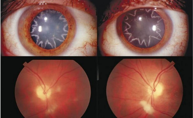 Δείτε πως έγιναν τα μάτια του όταν τον «χτύπησε» το ρεύμα