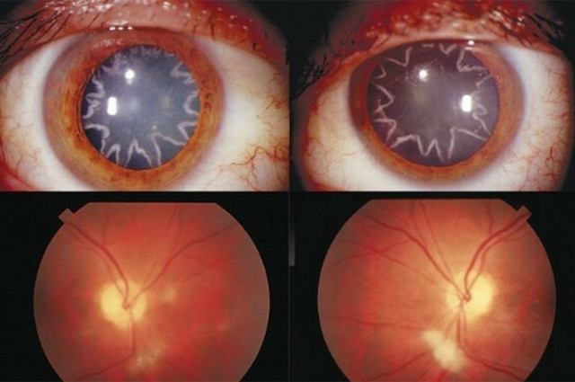 Δείτε τι έπαθαν τα μάτια του όταν τον «χτύπησαν» 14.000 βολτ