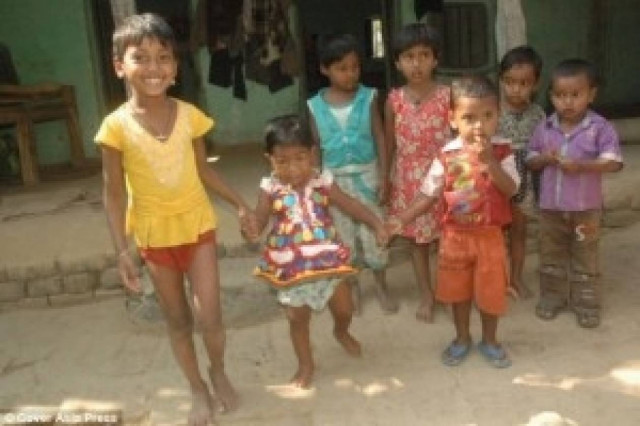 Συγκλονιστικές φώτο: 19χρονη «ζει» σε σώμα δίχρονου κοριτσιού