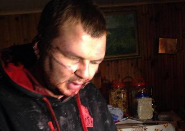 Ουκρανία: ΣΟΚ - Απήγαγαν, βασάνισαν και... σταύρωσαν διαδηλωτή!