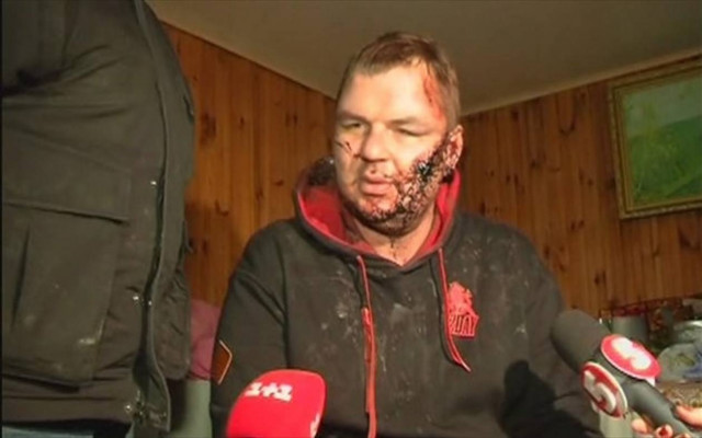 Ουκρανία: Σε κατ' οίκον περιορισμό ο ακτιβιστής Ντμίτρο Μπουλάτοφ