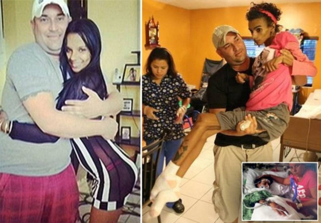 19χρονη έπεσε σε κώμα μετά από πλαστική στο στήθος - Δείτε πώς έγινε