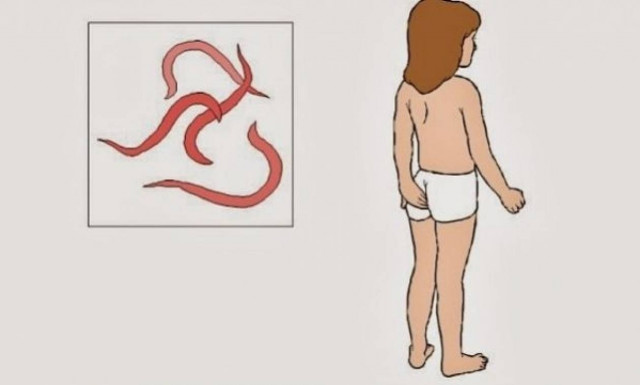 Το παιδί μου έβγαλε οξύουρους - Πώς τους αντιμετωπίζω;