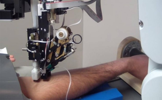 Veebot: Το ρομπότ που παίρνει αίμα εντελώς ανώδυνα!