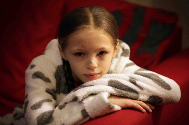 Δείτε πώς έγινε ένα 9χρονο κορίτσι από ένα μπουκάλι! Σκληρές εικόνες