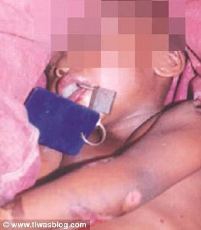 Έβαλε λουκέτο στο στόμα του μωρού του και το βασάνισε μέχρι θανάτου!