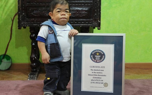 Η τραγική ιστορία ενός 28χρονου που ζει στο σώμα παιδιού (pics)