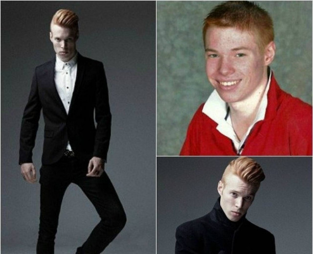 Από.. ασχημόπαπο, κύκνος στις σελίδες της Vogue