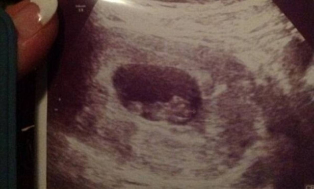 Περιμένει το τρίτο της παιδί και μας δείχνει το υπερηχογράφημά της!